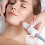 Best Skin Polishing Treatment in Vijayawada