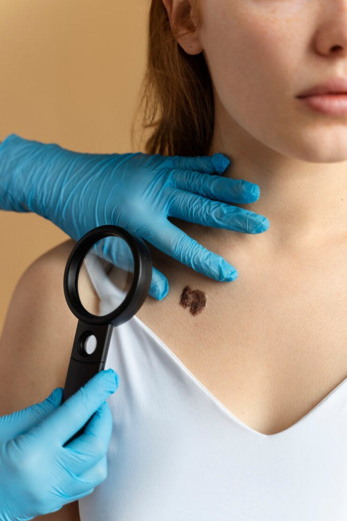 Best Skin Tag and Wart Removal in Vijayawada