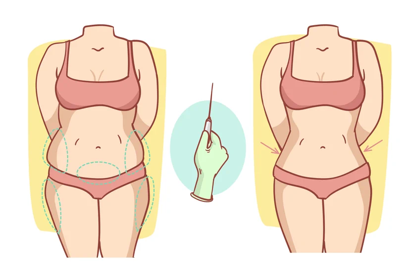 Best Liposuction Surgeon In Vijayawada